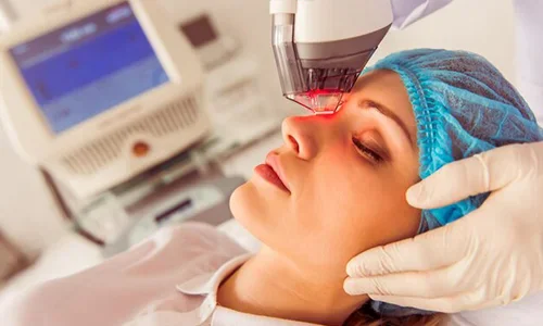 laser-treatments